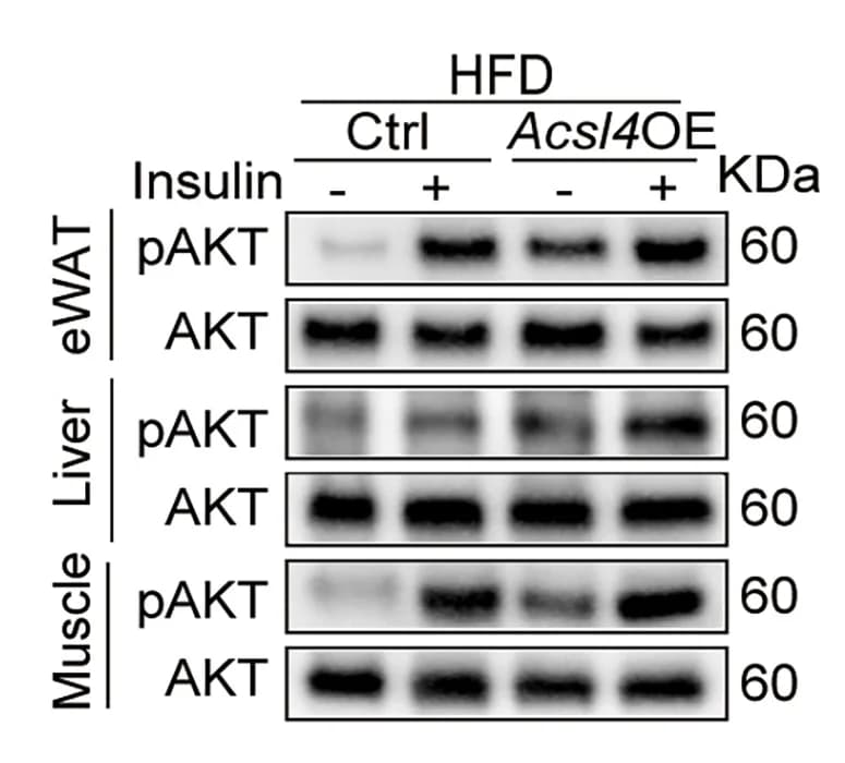 Open access visualization of Gel, Western Blot, p-AKT, eWAT, Liver