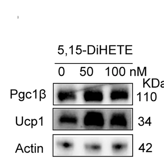 Open access visualization of Gel, Western Blot, Pgc1β, Ucp1, Actin Proteins