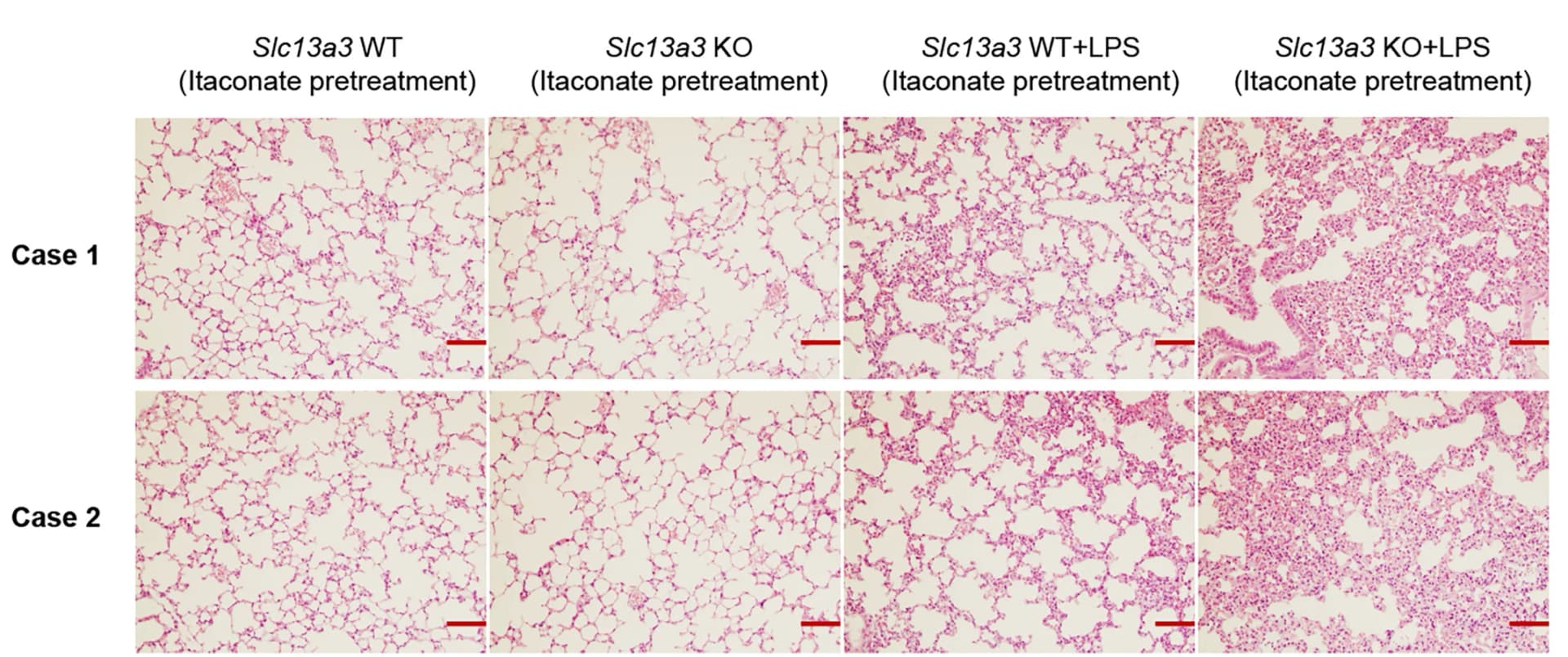 Open access visualization of Microscopy, Lung Tissues, Slc13a3 WT Mice, KO Mice, H&E Staining