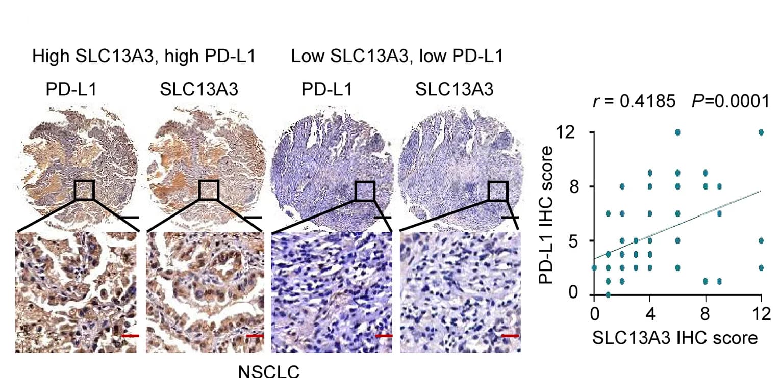 Open access visualization of Microscopy, Scatter Plot, Regression Plot, NSCLC Samples, SLC13A3