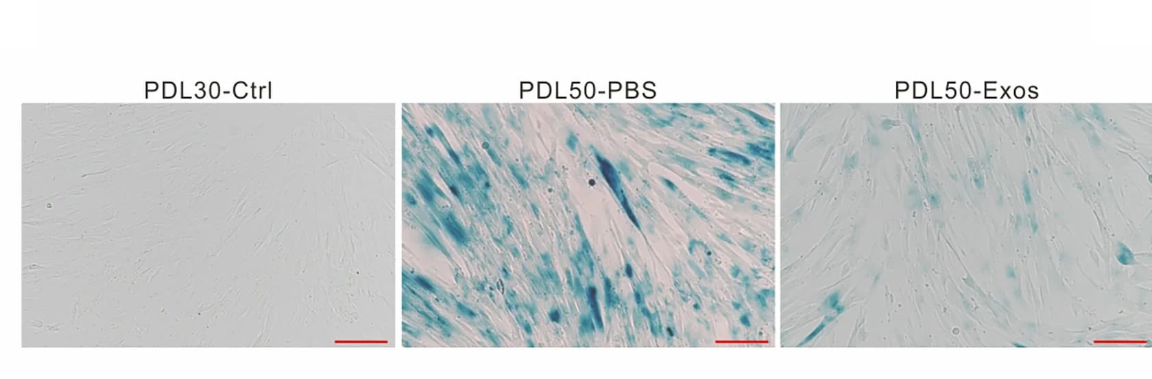 Open access visualization of Microscopy, SA-β-gal Staining, IMR-90 Cells