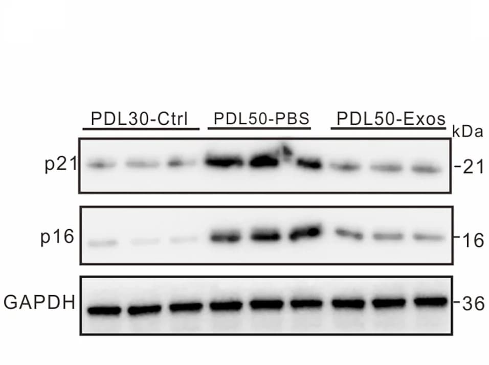 Open access visualization of Gel, Western Blot, p21, p16, IMR-90 Cells