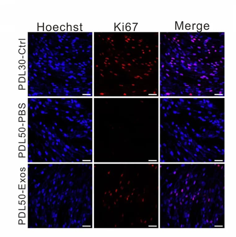 Open access visualization of Microscopy, Immunofluorescence, Ki67, IMR-90 Cells