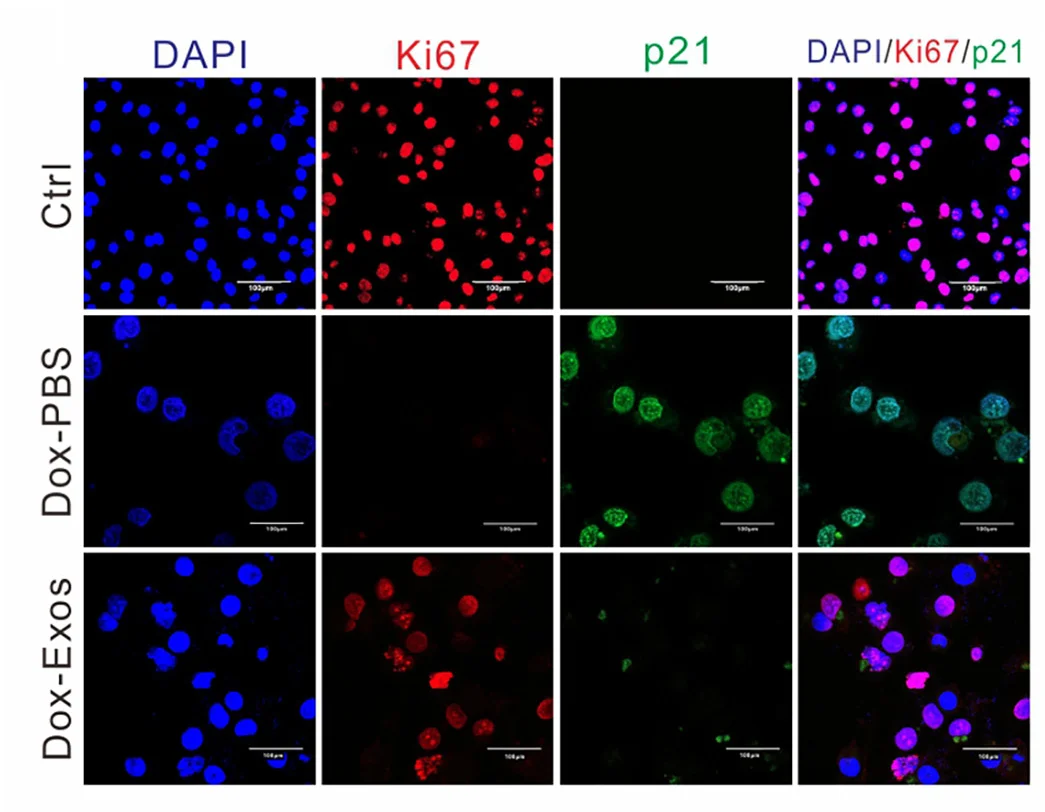 Open access visualization of Microscopy, Immunofluorescence, Ki67, p21, Ctrl Cells