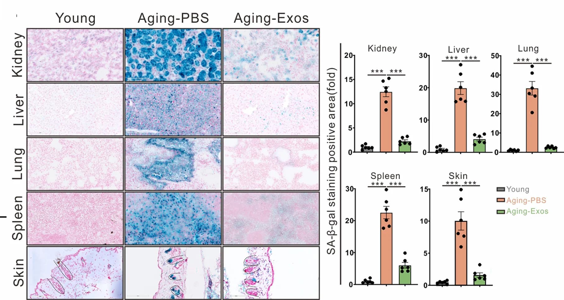 Open access visualization of Bar Plot, Error Bars, Microscopy, SA-β-gal Staining, Kidney