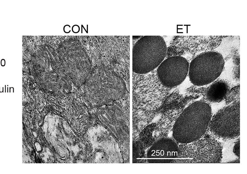 Open access visualization of Microscopy, Transmission Electron Micrographs, Rat Gastrocnemius, Control, Ethylacetate