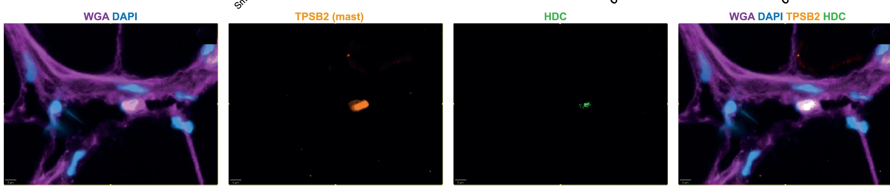 Open access visualization of Microscopy, RNAscope, HDC, Histamine Receptors, Mast Cells