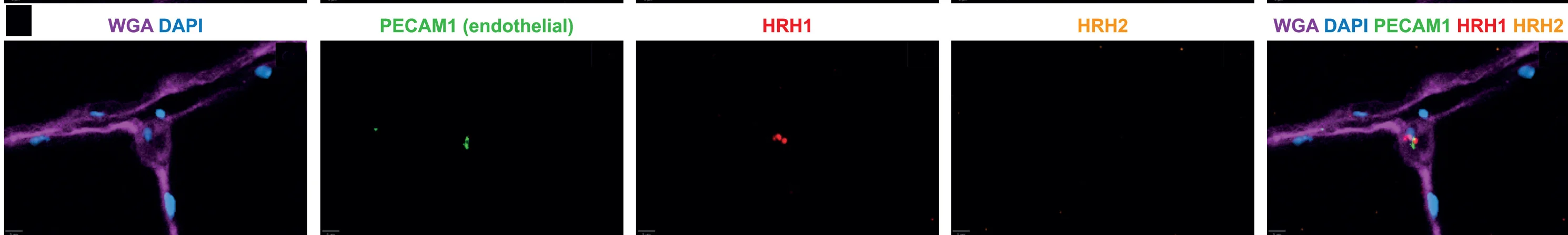 Open access visualization of Microscopy, RNAscope, HDC, Histamine Receptors, Endothelial Cells