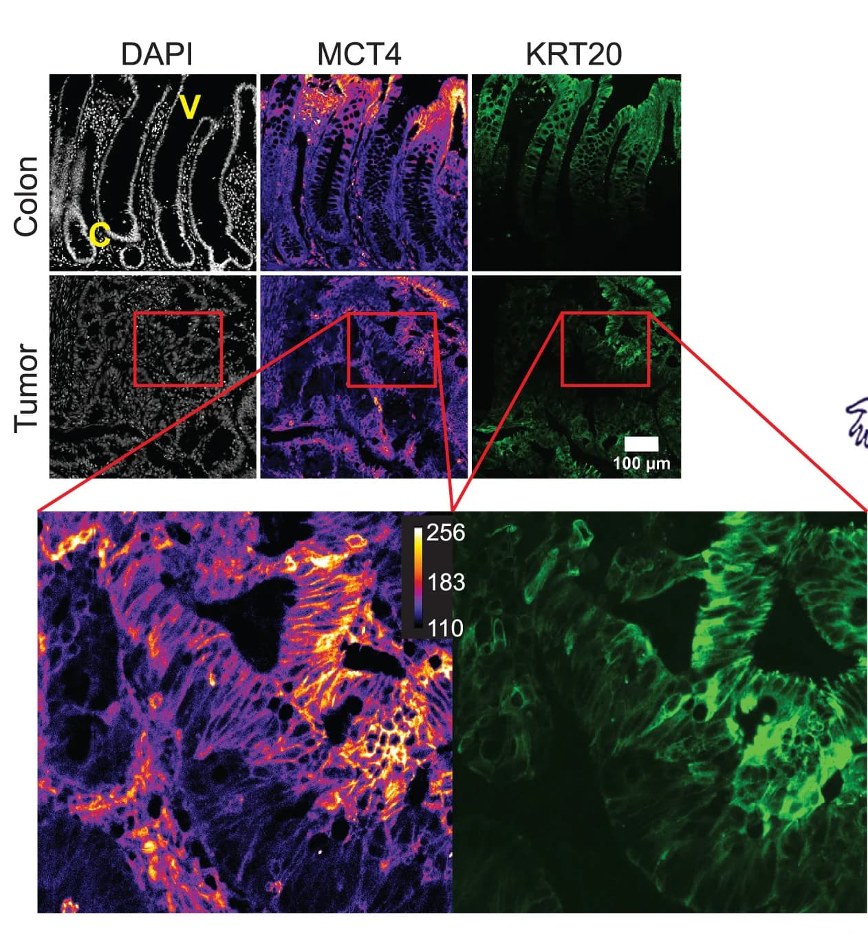 Open access visualization of Microscopy, Colon Biopsies, MCT4, KRT20, DAPI