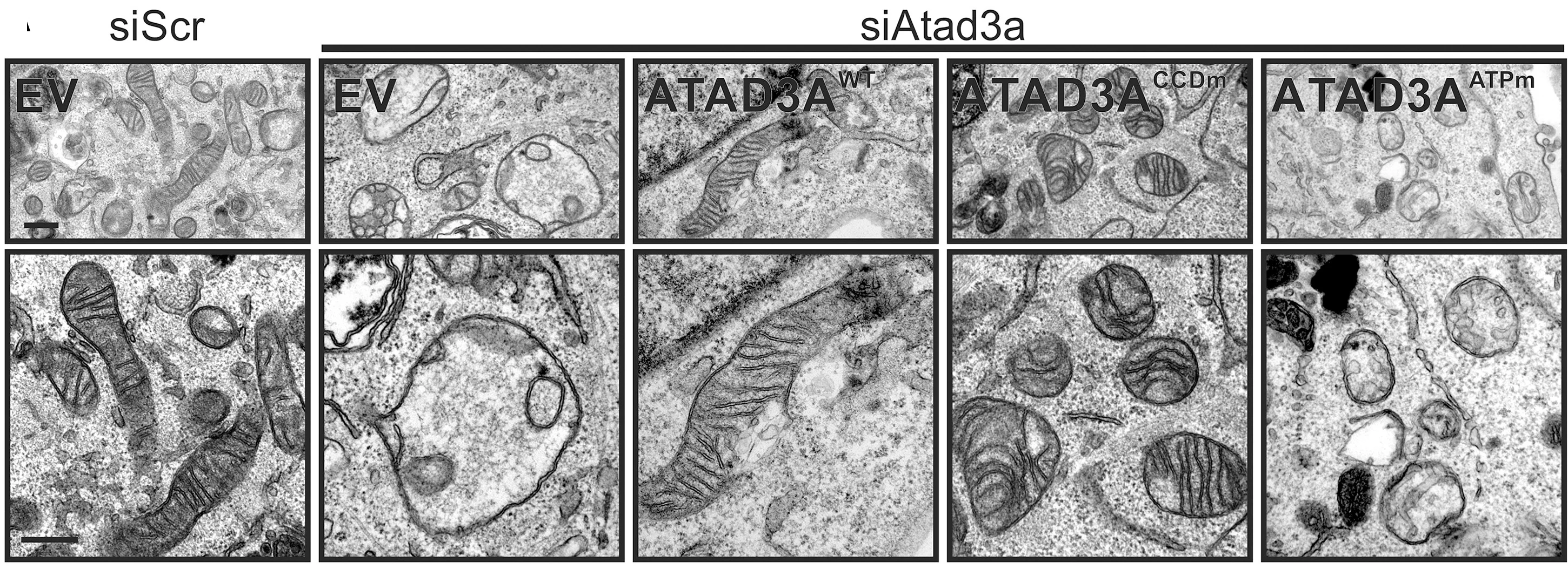 Open access visualization of Microscopy, Electron Micrographs, CLEM, mtRFP, MAFs