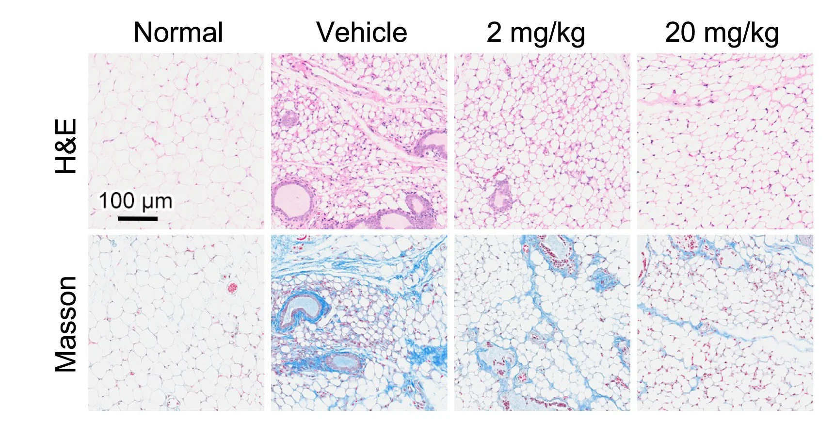 Open access visualization of Microscopy, H&E Staining, Masson's Trichrome Staining, iWAT
