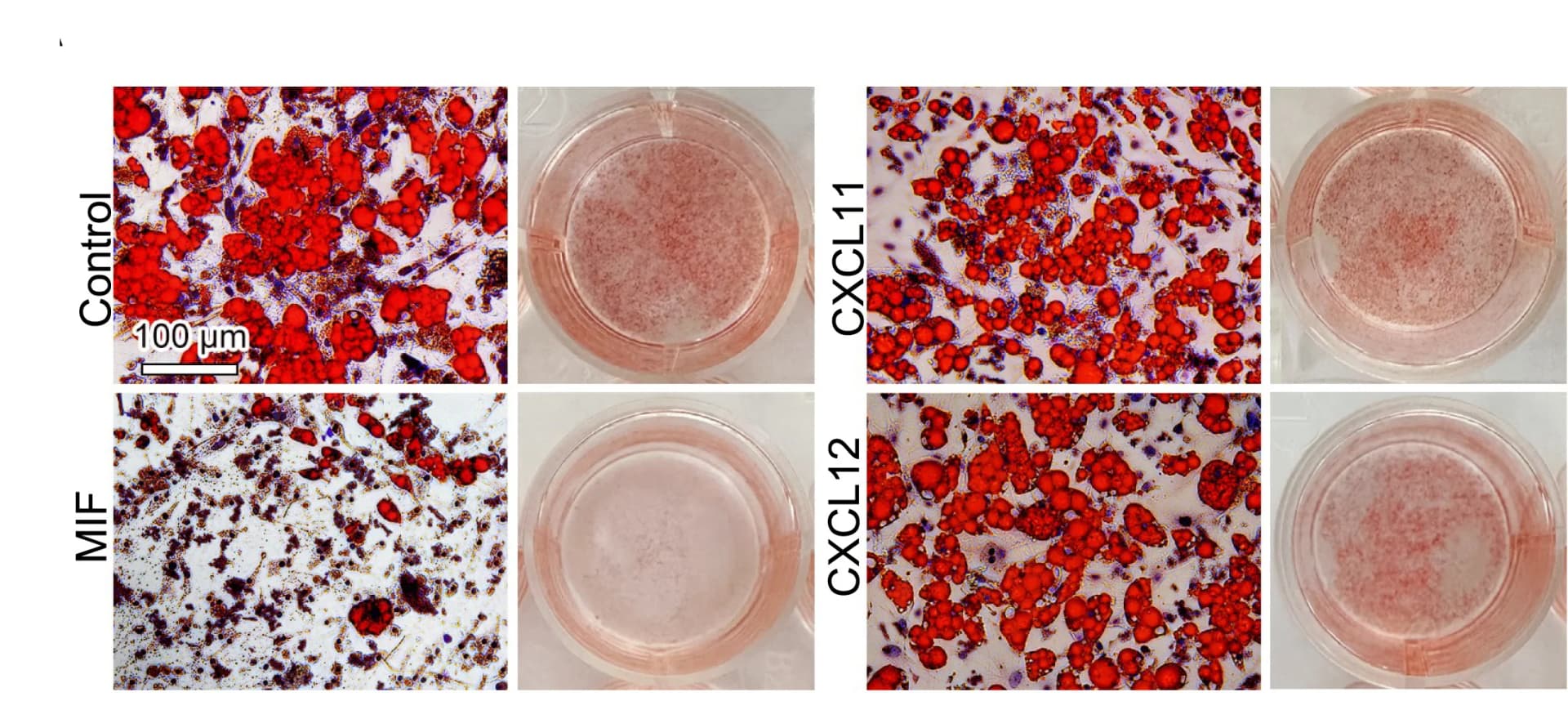 Open access visualization of Microscopy, Photo, SVF Cells, Oil Red O Staining, Adipocyte Differentiation