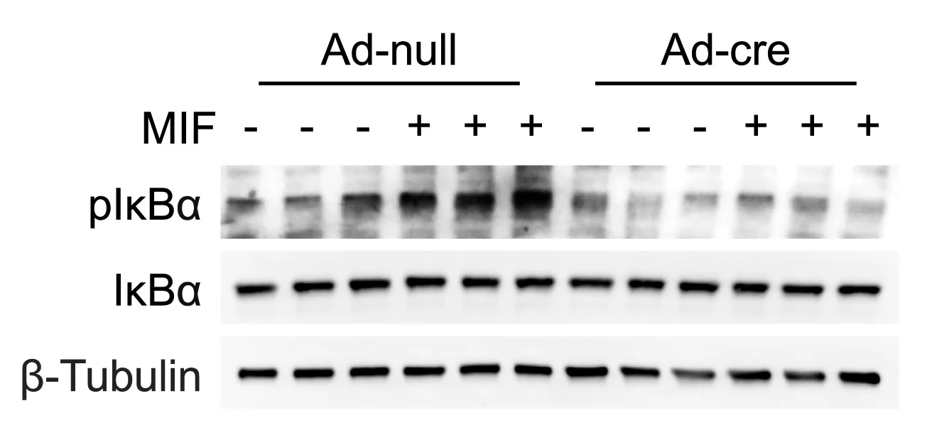 Open access visualization of Gel, Western Blots, Phosphorylated IκBα, Total IκBα, Ackr3fl/flSVF Cells