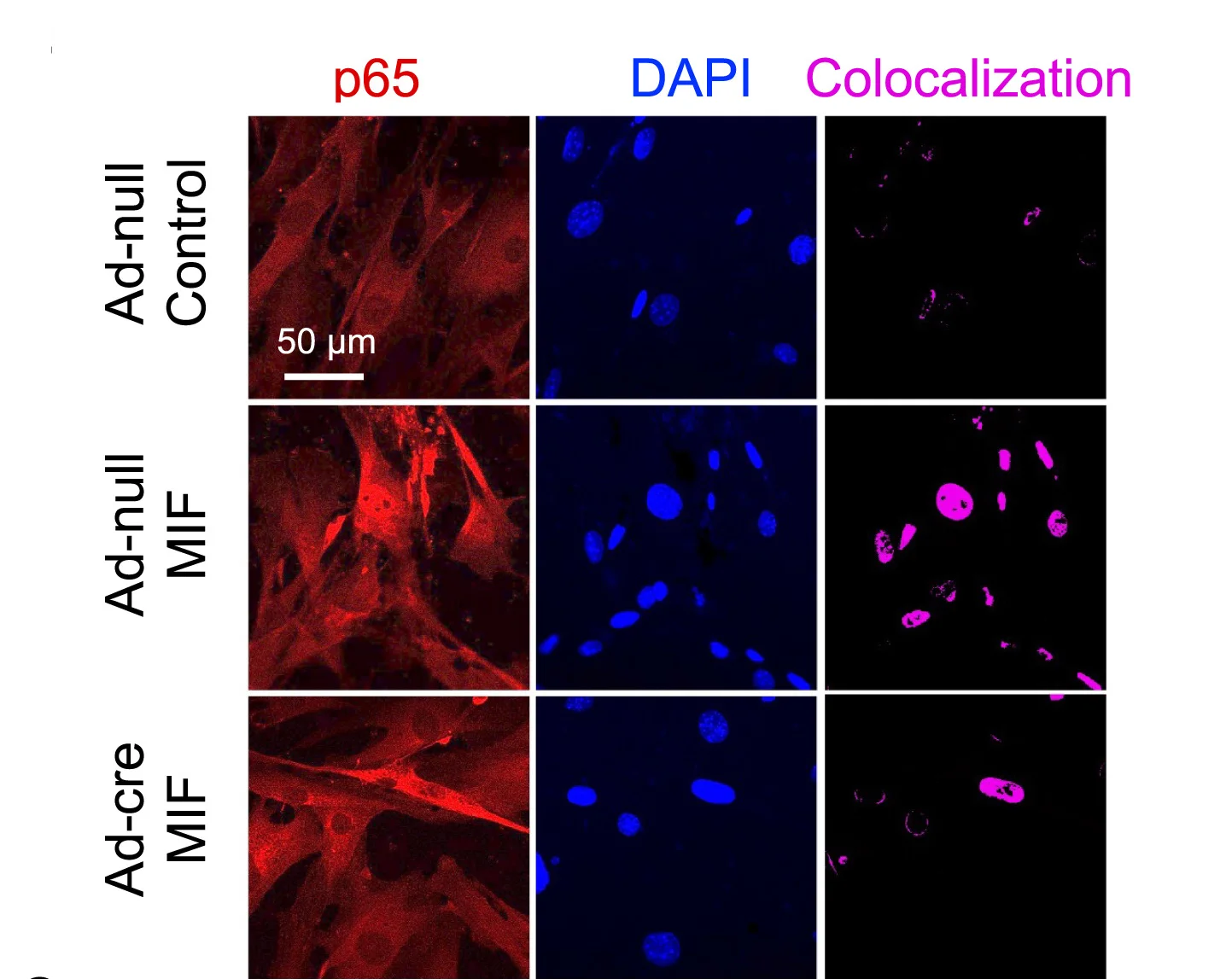 Open access visualization of Microscopy, Immunofluorescence Staining, NF-κB p65, Ackr3fl/flSVF Cells, Adenovirus