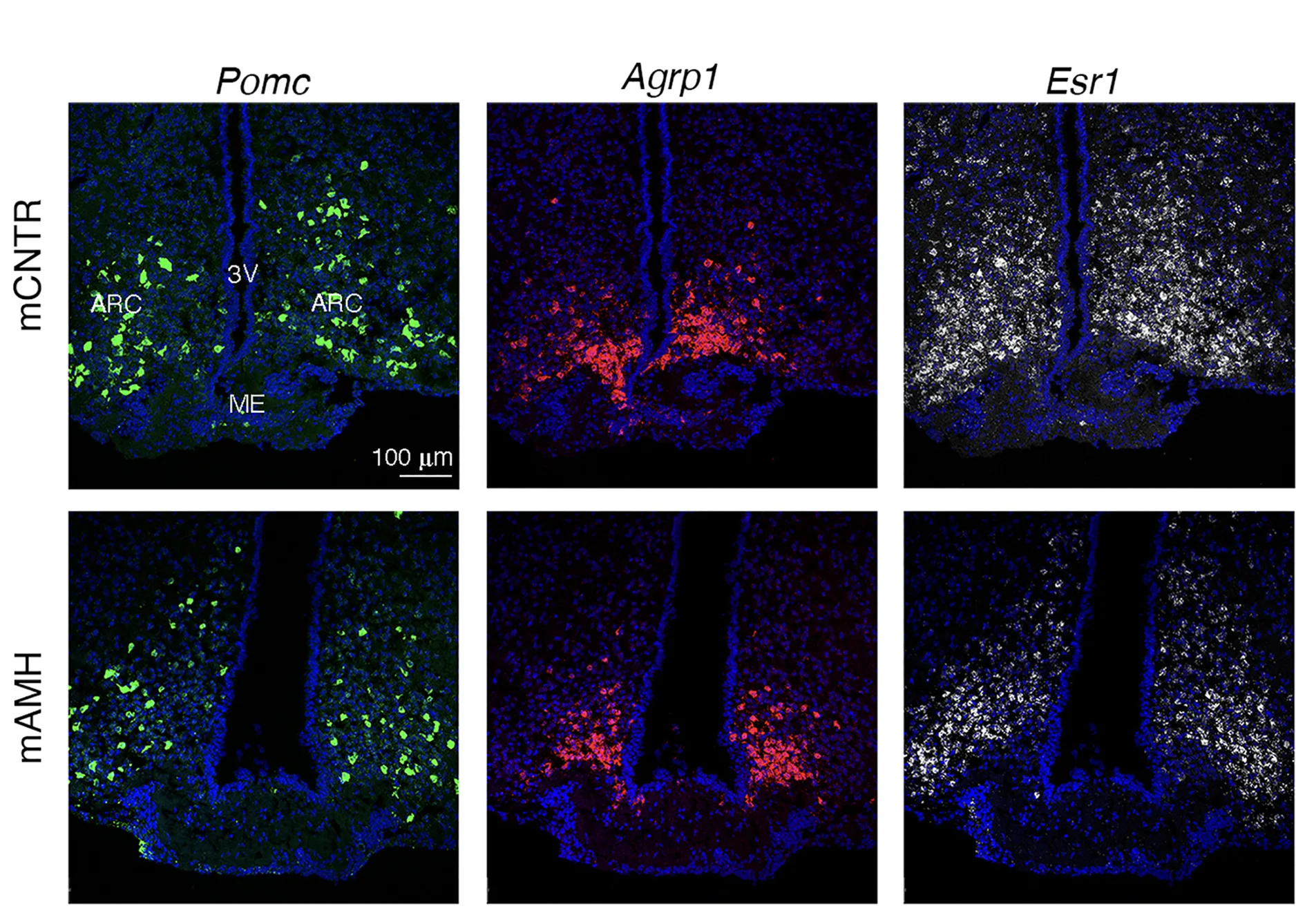 Open access visualization of Microscopy, Coronal section, MBH, ARC, Median eminence