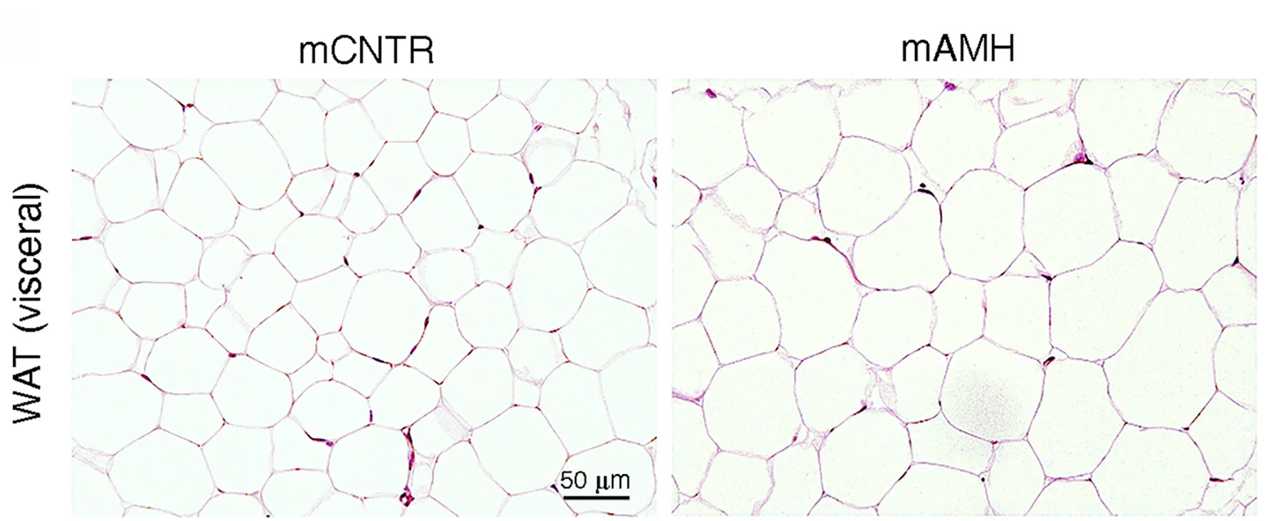 Open access visualization of Microscopy, Histological staining, Hematoxylin, Eosin, Adipose tissue