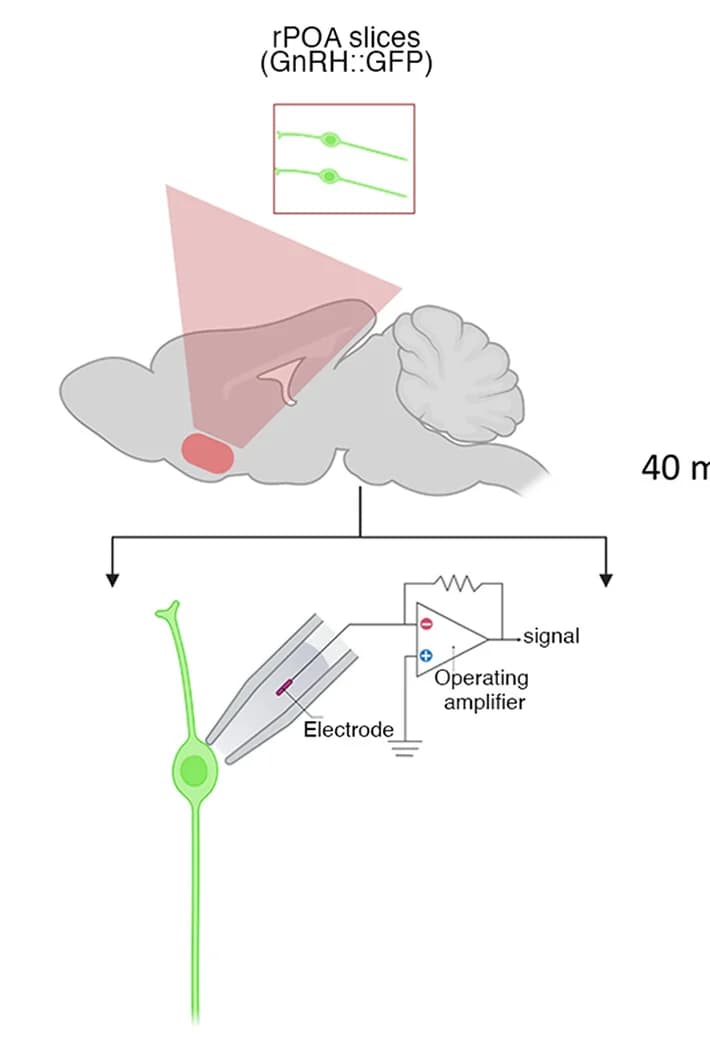 Open access visualization of Illustration, Workflow, Whole-Cell Current-Clamp, Recording Set-Up