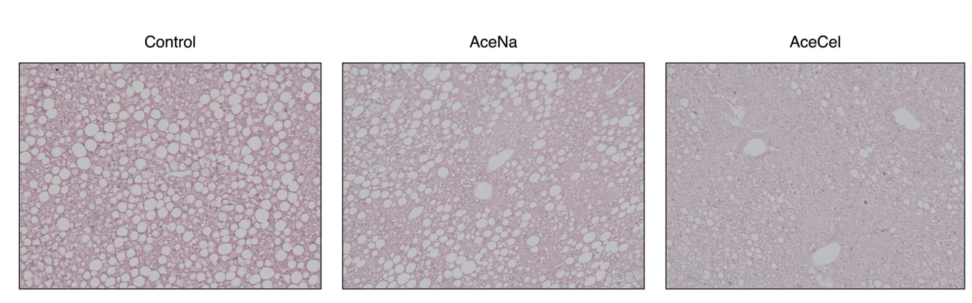 Open access visualization of Microscopy, H&E Staining, Liver, ob/ob Mice