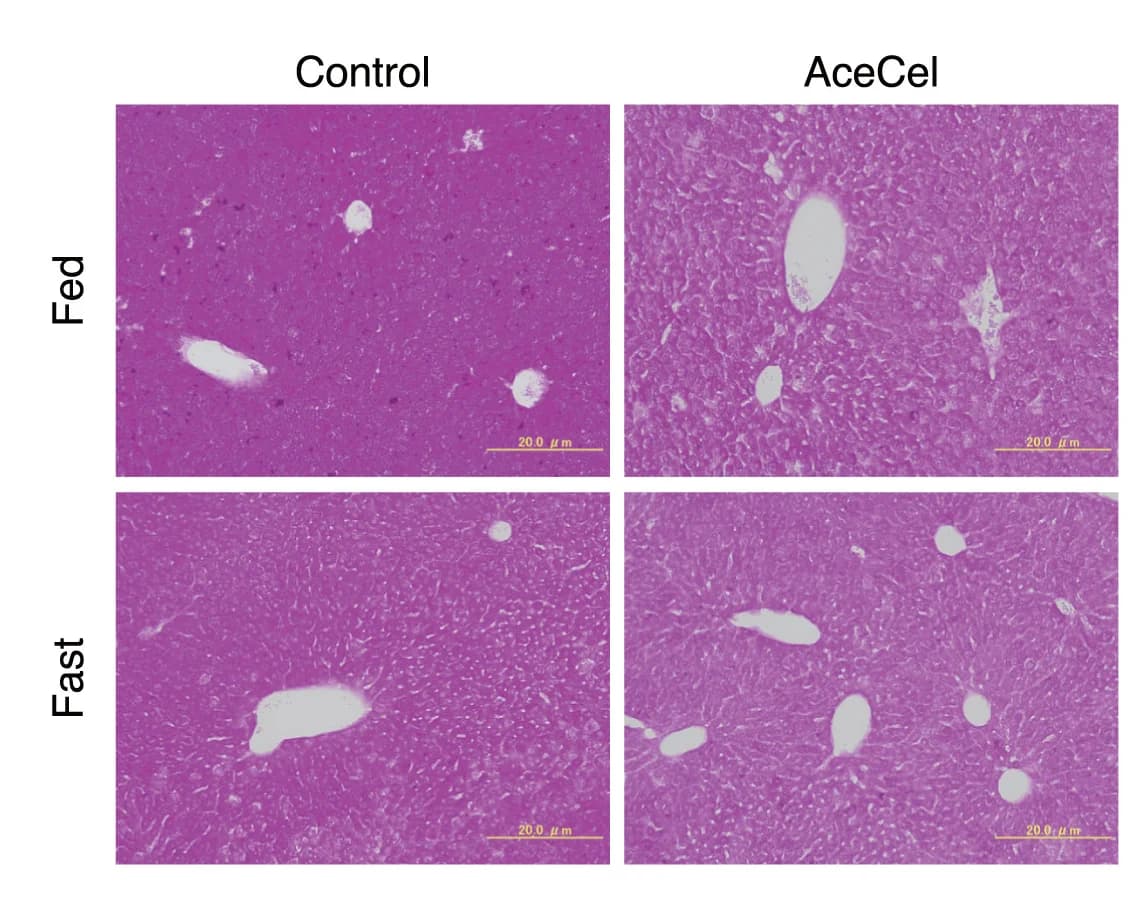 Open access visualization of Microscopy, Photo, PAS Staining, Liver