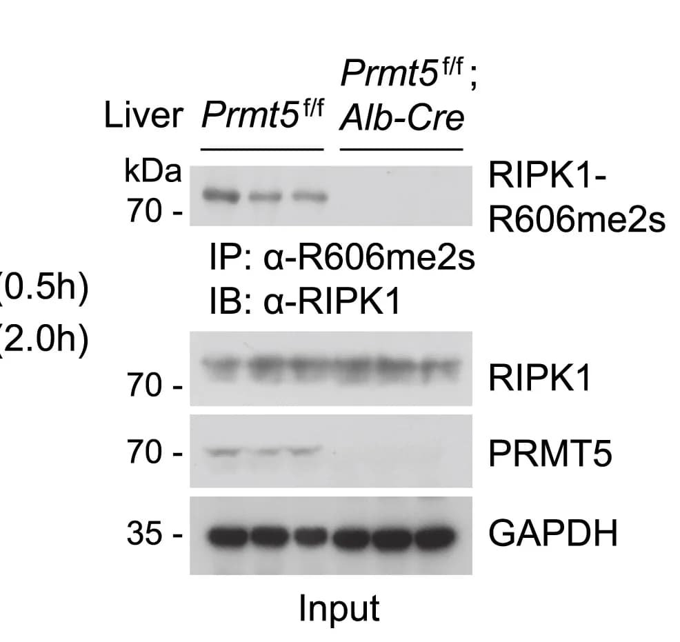 Open access visualization of Gel, Immunoprecipitation, Immunoblotting, RIPK1-R606me2s, Liver Lysates