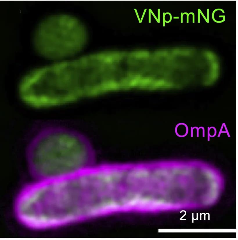 Open access visualization of Microscopy, mCherry, mNeongreen, SIM Fluorescence, VNp-mNeongreen
