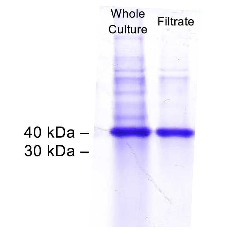 Open access visualization of Gel, Soluble Yield, Cell Extracts, Filtered Media, Recombinant Protein