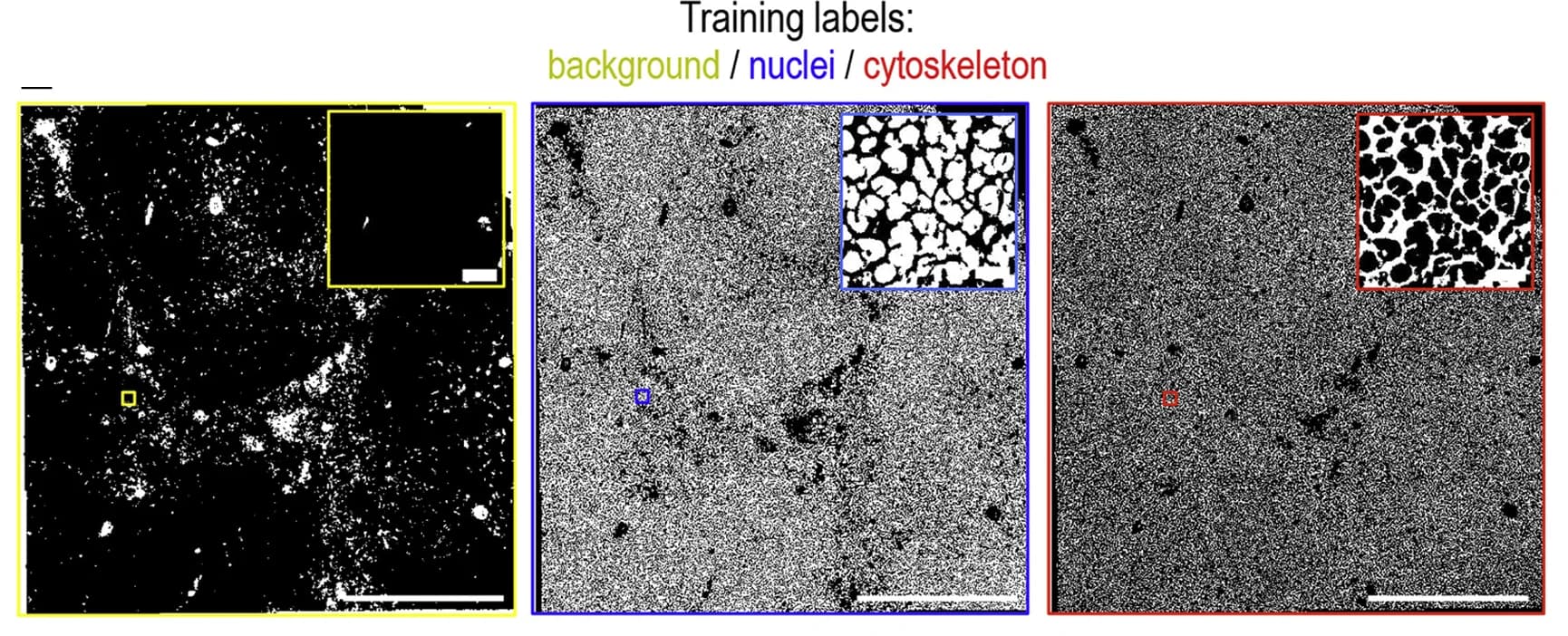 Open access visualization of Microscopy, Pixel Classification, Background, Nuclei, Cytoskeleton