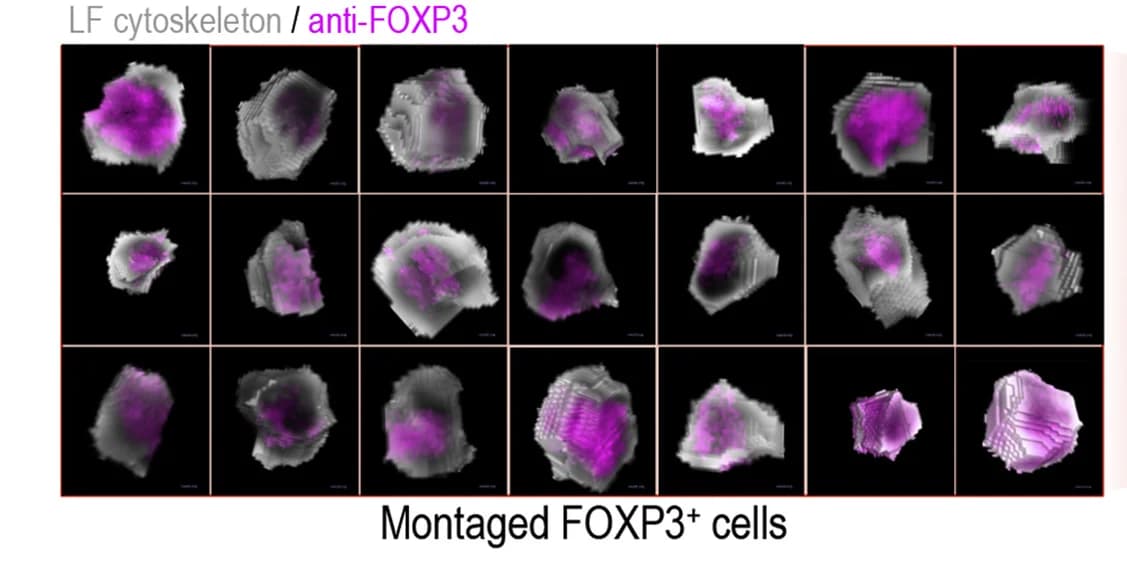 Open access visualization of Microscopy, Photo, 3D projections, FOXP3+cell objects, Label-free segmentation