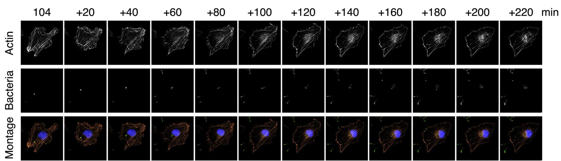 Open access visualization of Microscopy, Bacteria, Host Cell, Actin Filaments, Type III Secretion System