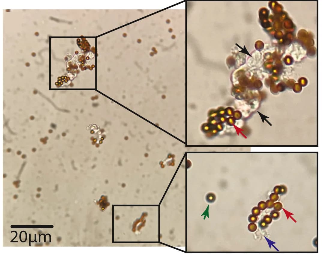 Open access visualization of Microscopy, Light Microscopy, Microvascular Fragments, Magnetic Beads
