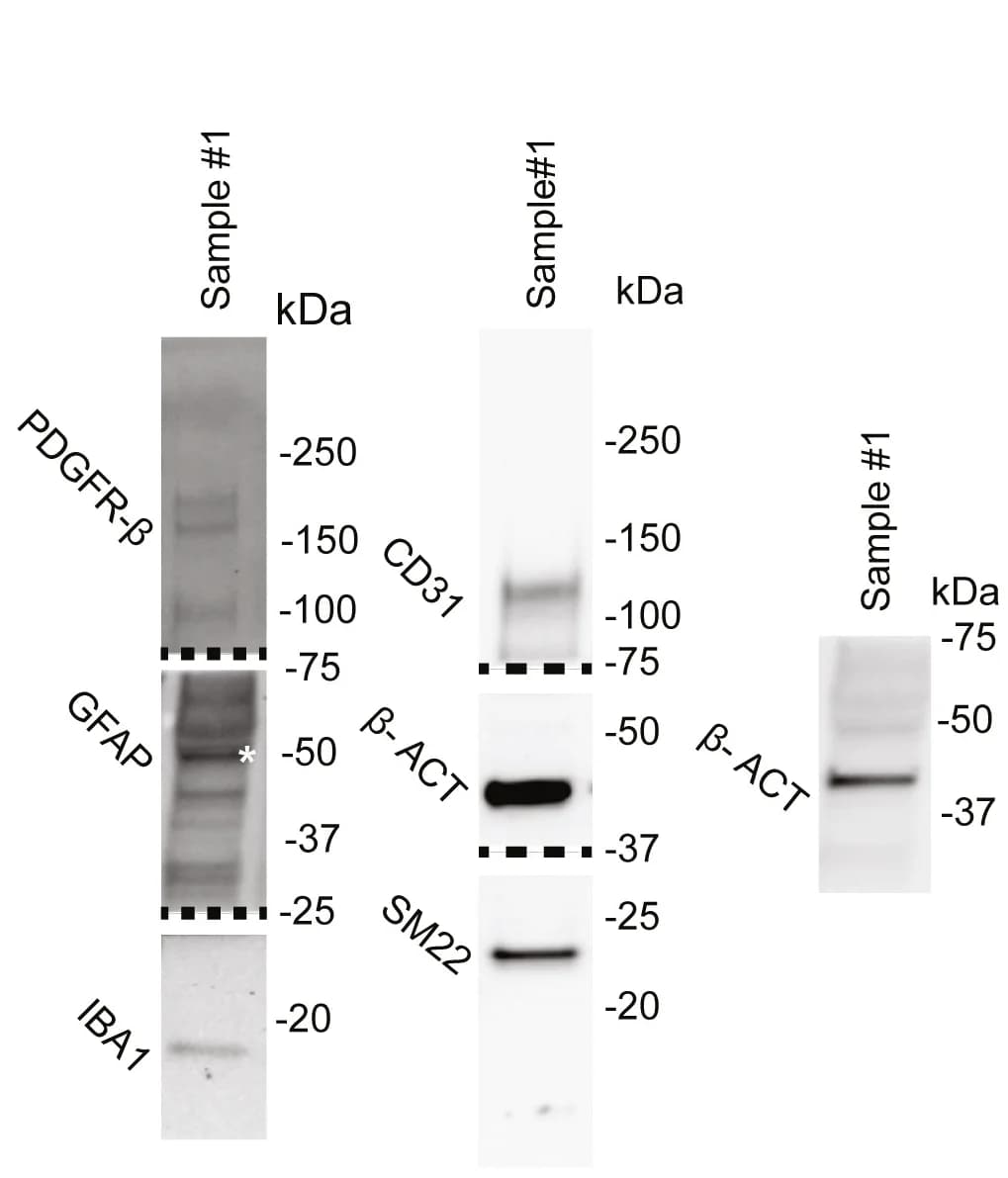 Open access visualization of Gel, Western Blot, Protein Content, Single-Cell Suspensions, Protein Ladder