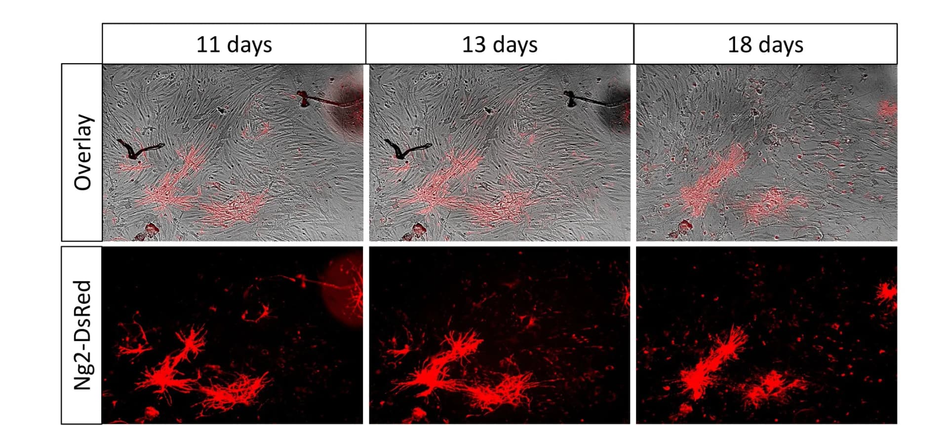Open access visualization of Microscopy, Cell Culture, Cell Death, Pericyte Processes