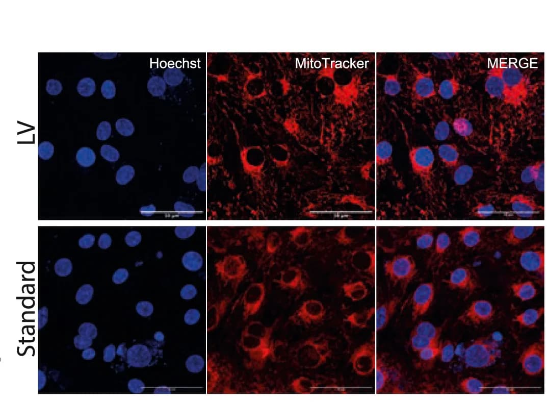 Open access visualization of Microscopy, Mitochondria, Micrographs
