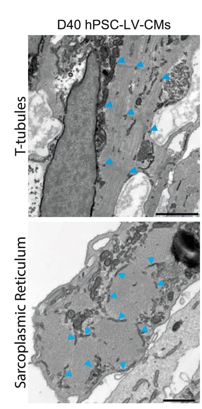 Open access visualization of Microscopy, Transmission electron micrographs, T-tubules, Sarcoplasmic reticulum