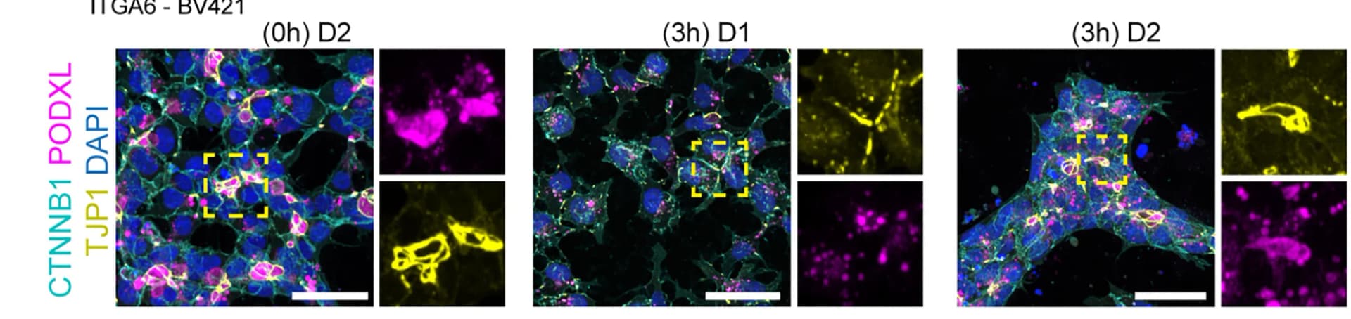 Open access visualization of Microscopy, Immunofluorescence, CTNNB1, PODXL, TJP1