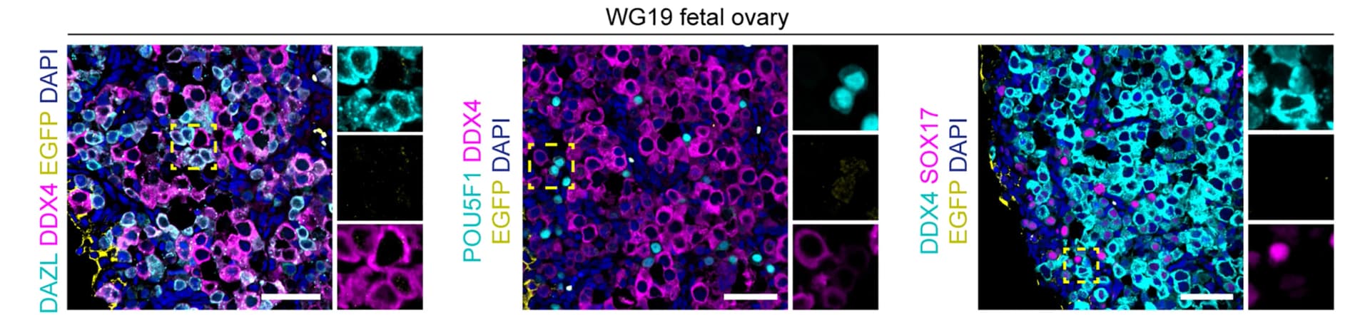 Open access visualization of Microscopy, Immunofluorescence, EGFP, DDX4, DAZL