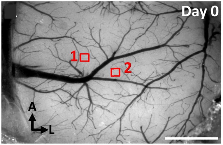 Open access visualization of Microscopy, Bright-Field Image, Cortical Surface, Reporter Mouse, Cranial Window