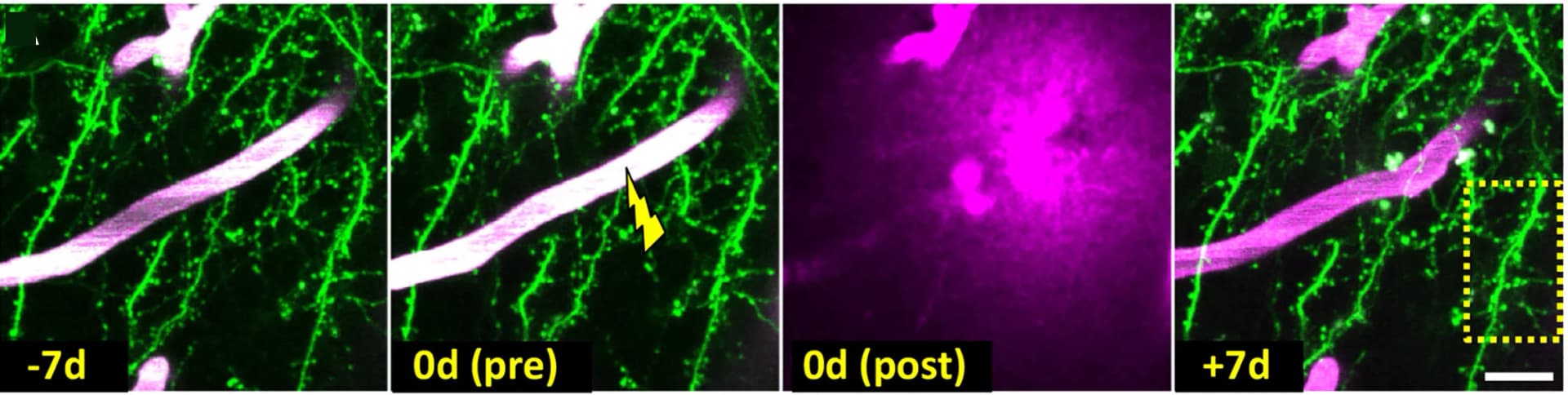 Open access visualization of Microscopy, Two-photon Images, Cortical Dendrites, Capillary Rupture