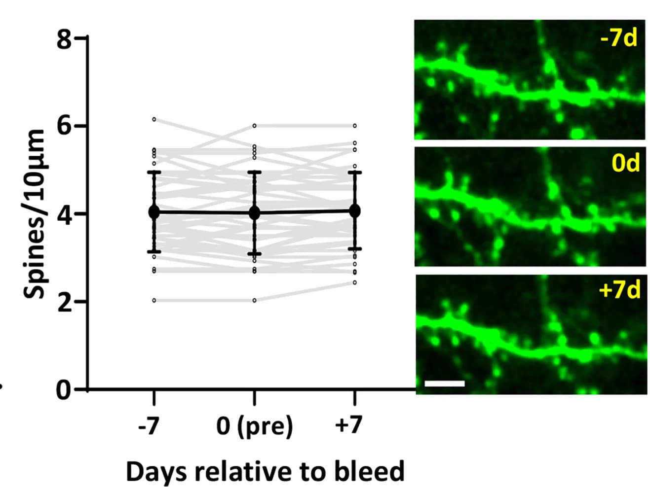 Open access visualization of Line Plot, Error Bars, Microscopy, Dendritic Spine Density, Capillary Rupture