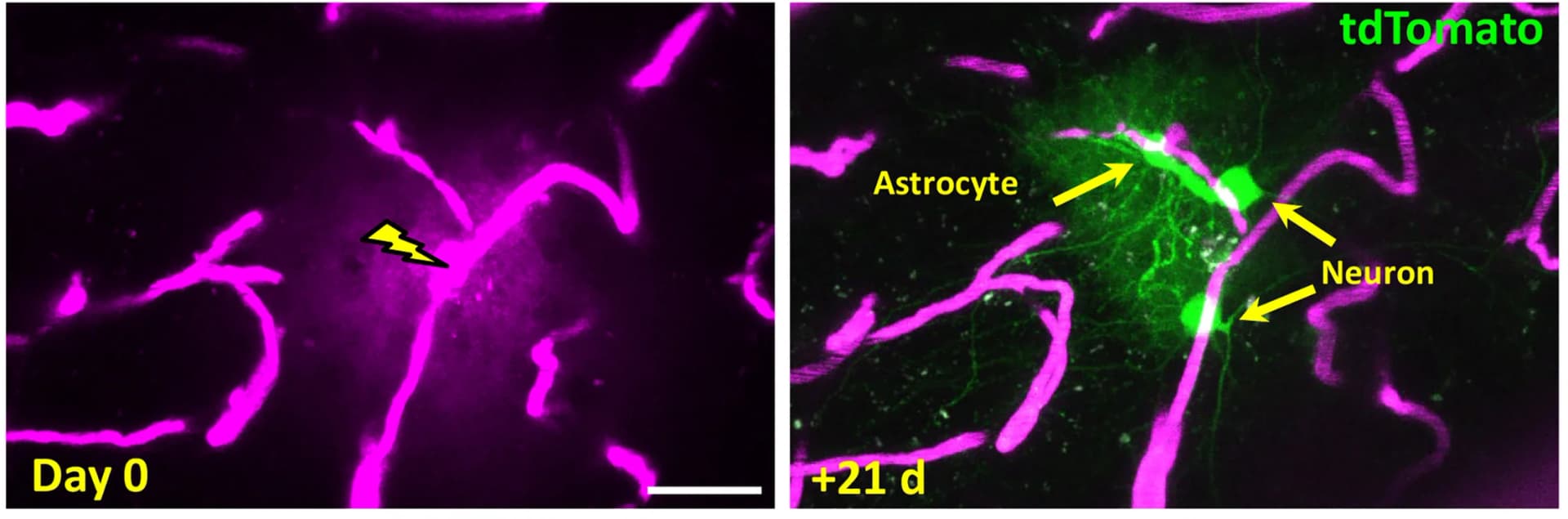 Open access visualization of Microscopy, Two-photon Microscopy, Cortical Capillary, AAV, Astrocytes
