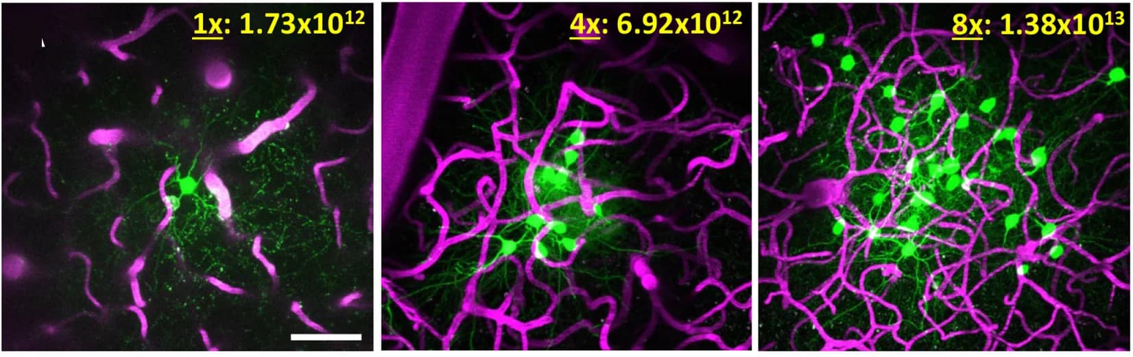 Open access visualization of Microscopy, AAV, tdTomato reporter mice, Capillary rupture, Maximum intensity z-projection