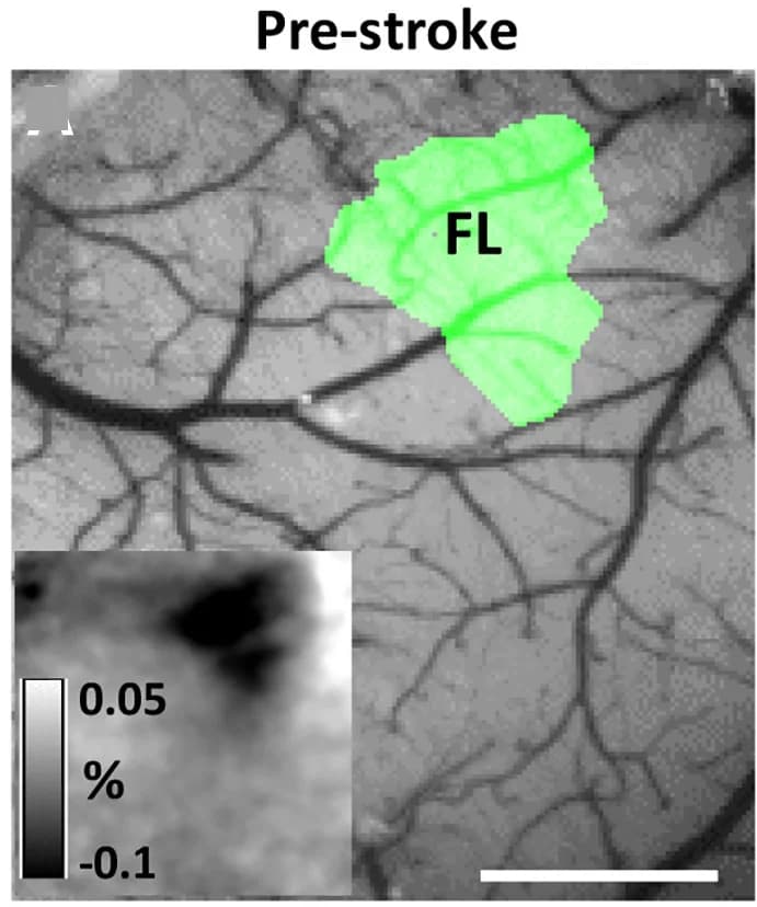 Open access visualization of Microscopy, Bright-Field Images, Cortical Surface, Intrinsic Optical Signal Maps, Forelimb Somatosensory Cortex