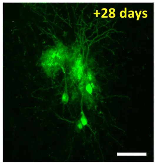 Open access visualization of Microscopy, Confocal Image, Coronal Brain Section, tdTomato-labeled Cells