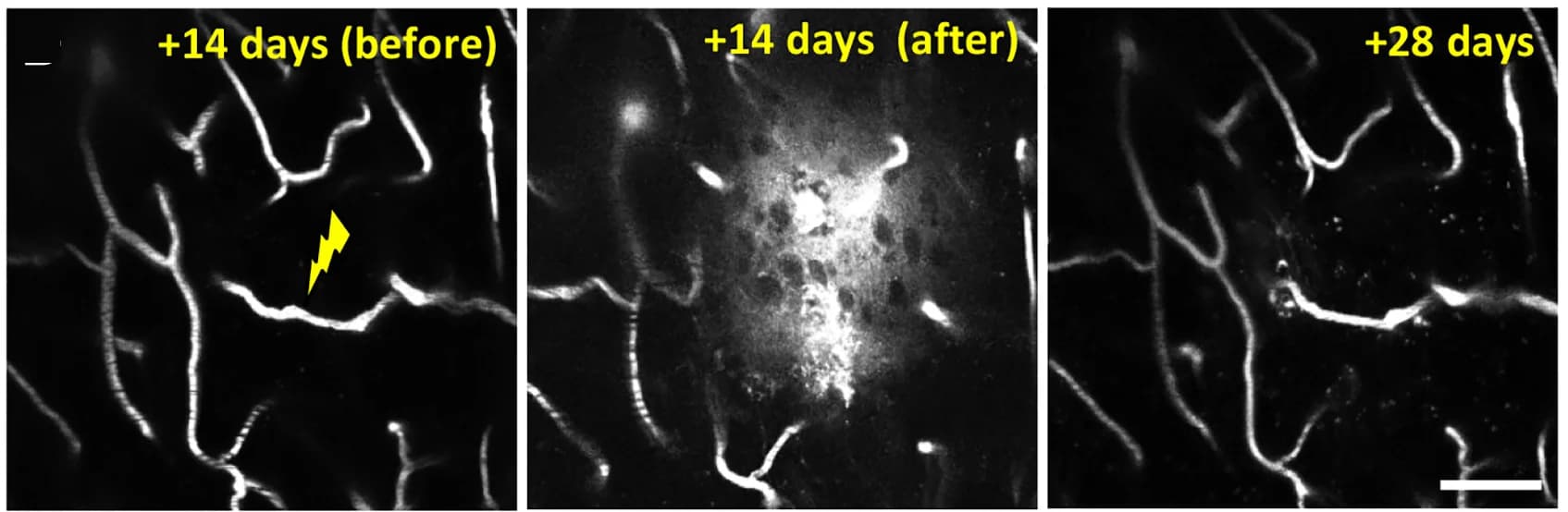 Open access visualization of Microscopy, Two-Photon Images, Capillary Rupture, Blood Flow