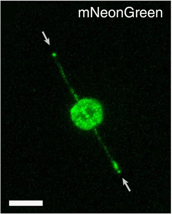 Open access visualization of Microscopy, Maximum Intensity Projection, Dual-Knockin Construct, Ciliary Tips