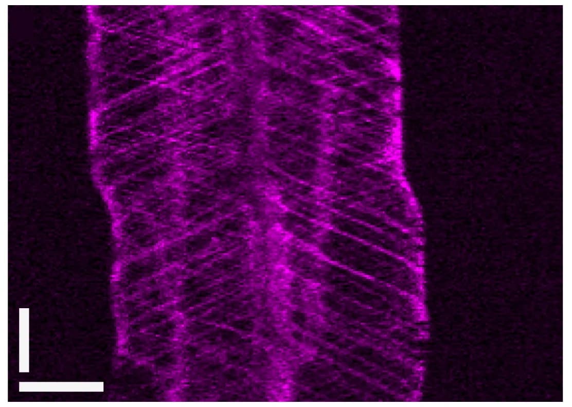 Open access visualization of Microscopy, IFT Kymogram, Marker-Free Progeny, IFT46-mScarletI DRC4, Back-Crossing
