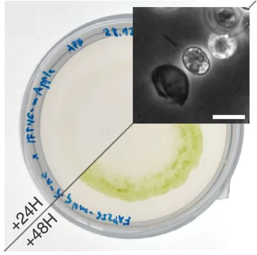 Open access visualization of Microscopy, Photo, Vegetative Cells, Zygospores, Sporangial Walls