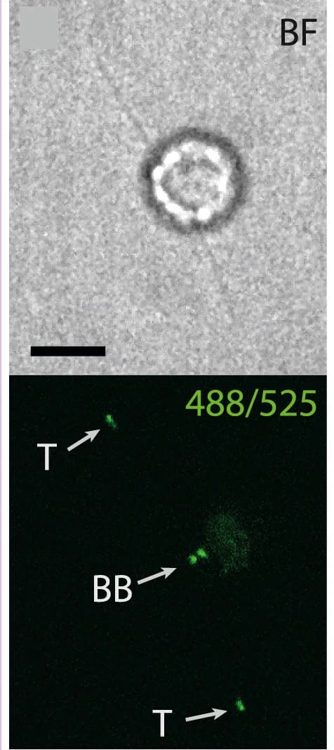 Open access visualization of Microscopy, Photo, Bright-Field Micrographs, Fluorescence Micrographs, FAP256-mNeonGreen Knockin Cell