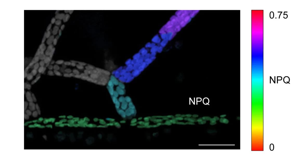 Open access visualization of Microscopy, Artificial Color Image, NPQ, Caulonema Cells, Chloronema Cells