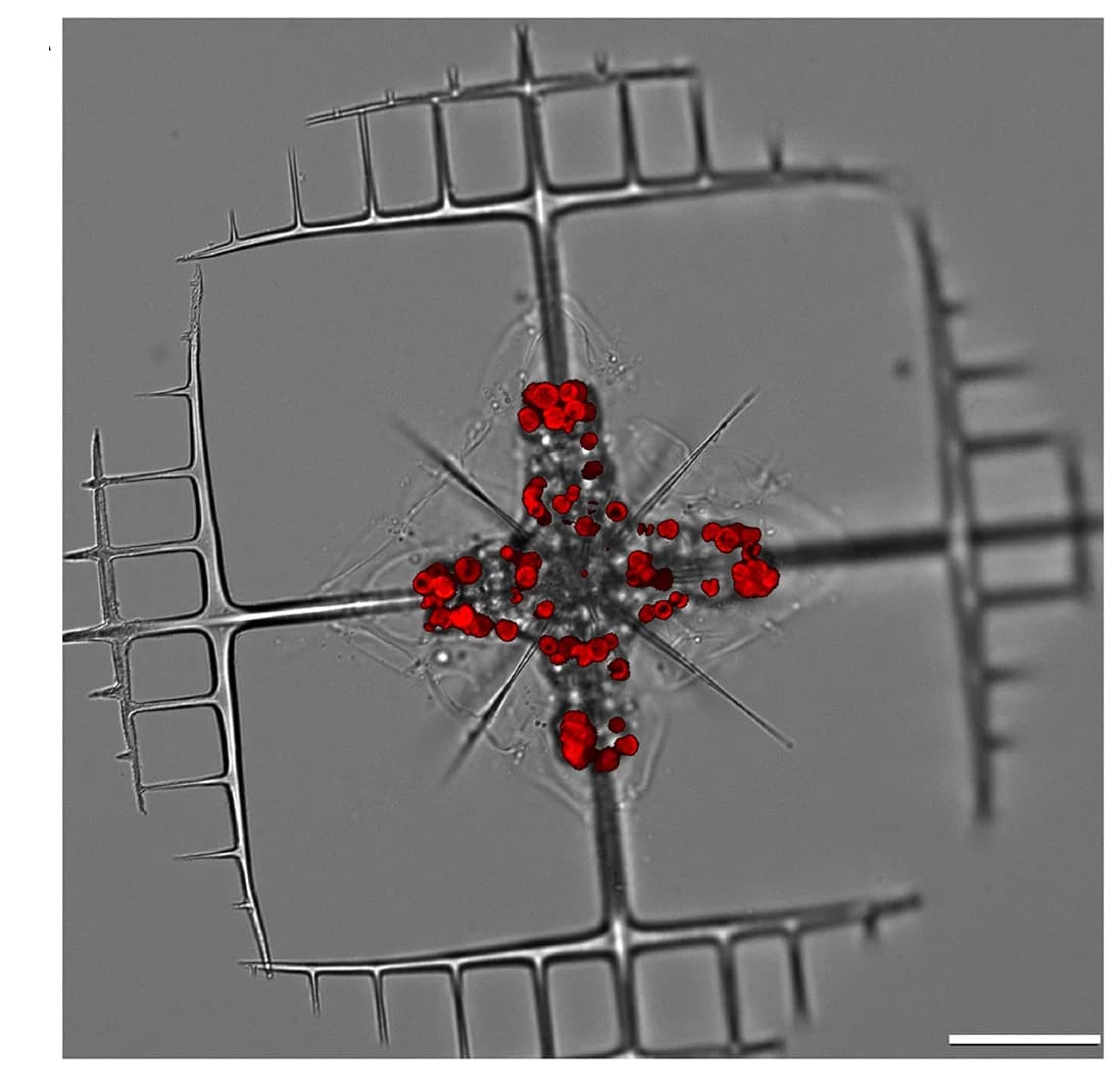 Open access visualization of Microscopy, Bright-Field, Chl Fluorescence, Acantharian Cell, Symbiotic Microalgae